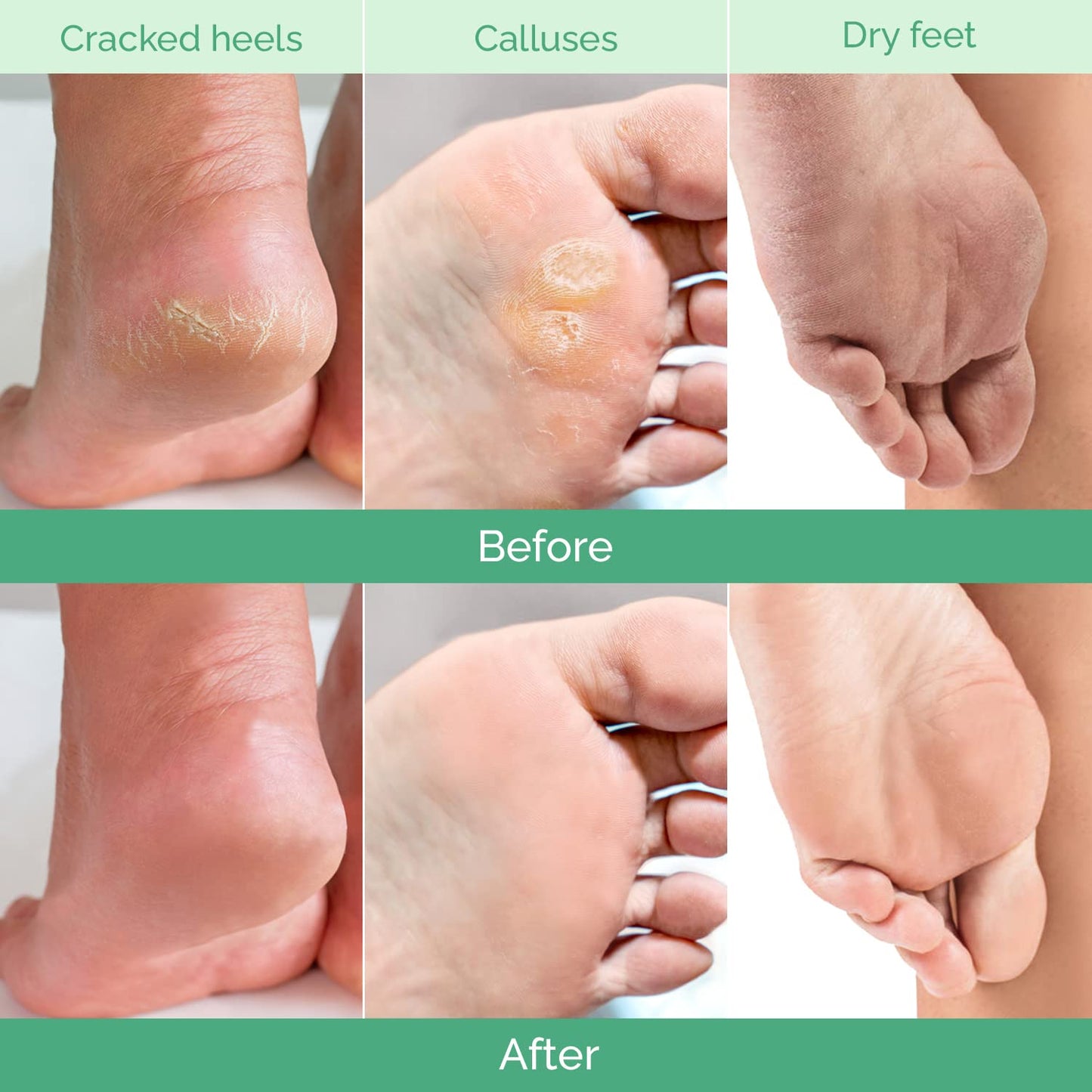 The Peach Foot Peel Mask (2 Pack)