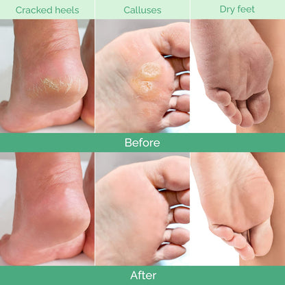 The Peach Foot Peel Mask (2 Pack)